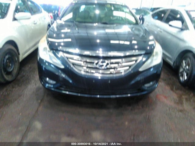 Photo 5 VIN: 000EC4AB8CH464794 - HYUNDAI SONATA 