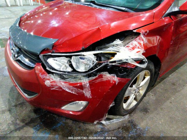 Photo 5 VIN: 00PDH4AE4BH038056 - HYUNDAI ELANTRA 