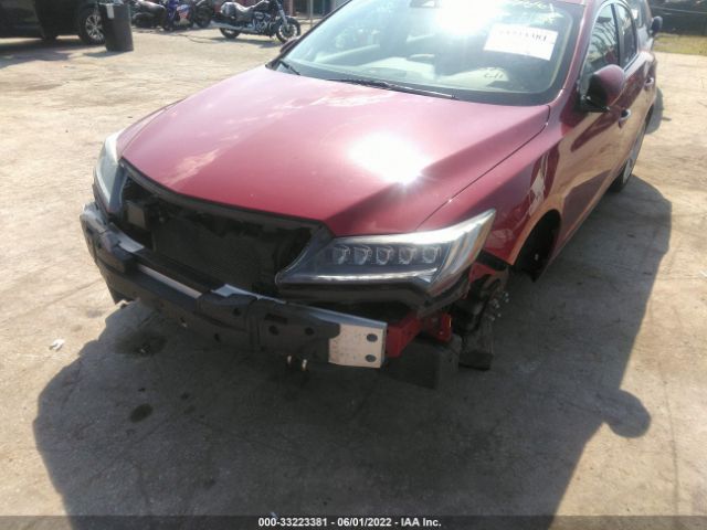 Photo 5 VIN: 19UDE2F31HA000967 - ACURA ILX 