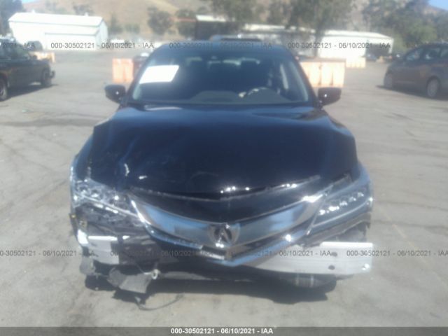 Photo 5 VIN: 19UDE2F31JA001400 - ACURA ILX 