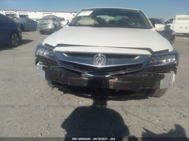 Photo 5 VIN: 19UDE2F43JA000001 - ACURA ILX 