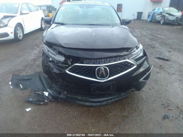 Photo 5 VIN: 19UDE2F77MA001635 - ACURA ILX 