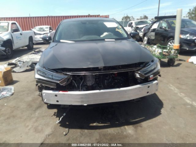 Photo 5 VIN: 19UDE2F78MA007332 - ACURA ILX 