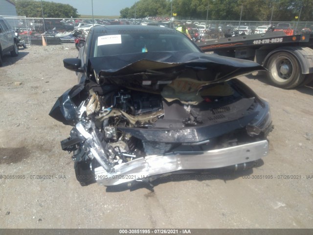 Photo 5 VIN: 19UDE2F78MA008416 - ACURA ILX 