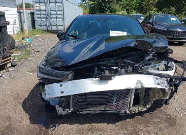 Photo 5 VIN: 19UDE2F85MA006745 - ACURA ILX 