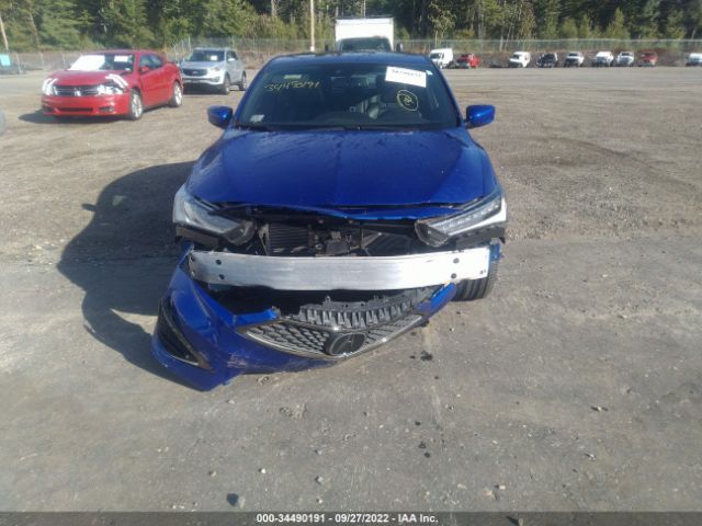 Photo 5 VIN: 19UDE2F8XMA004974 - ACURA ILX 