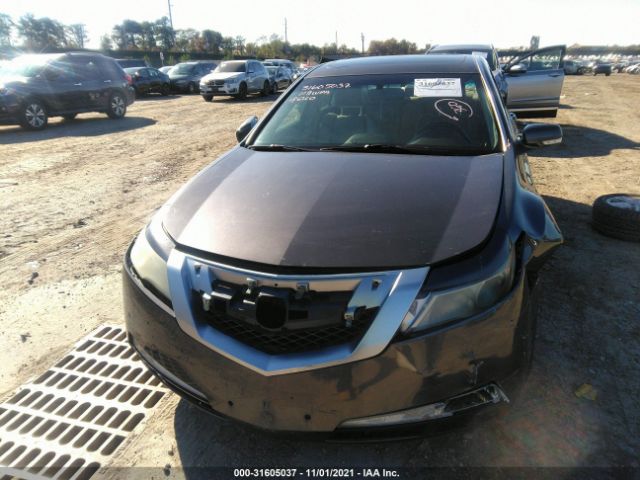 Photo 5 VIN: 19UUA8F21BA000030 - ACURA TL 