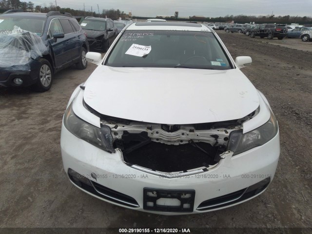 Photo 5 VIN: 19UUA8F22DA000976 - ACURA TL 