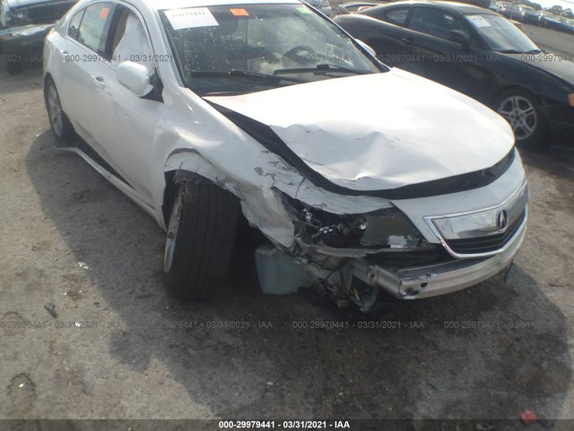 Photo 5 VIN: 19UUA8F23CA026551 - ACURA TL 