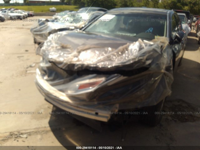 Photo 5 VIN: 19UUA8F25BA004646 - ACURA TL 