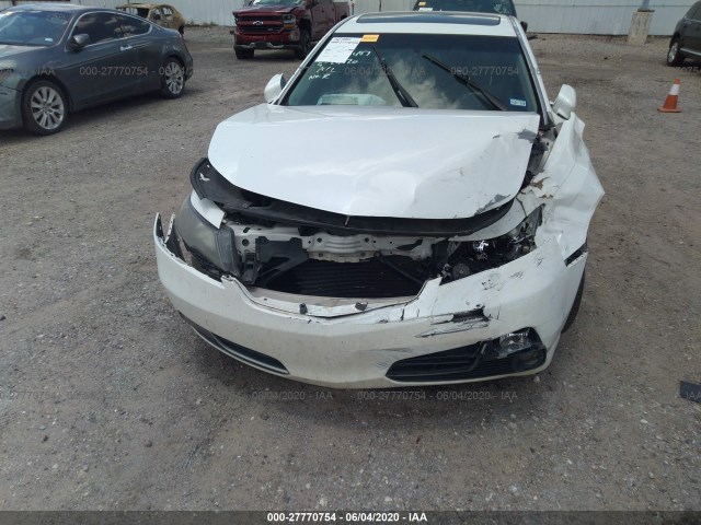 Photo 5 VIN: 19UUA9F53CA009359 - ACURA TL 