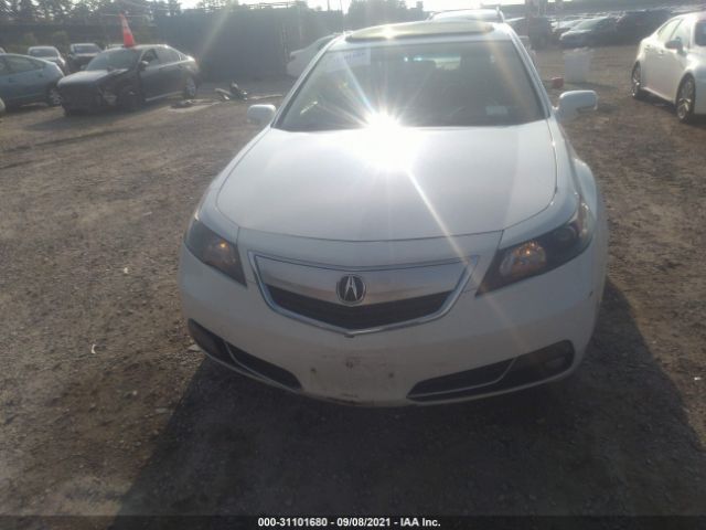 Photo 5 VIN: 19UUA9F54CA011086 - ACURA TL 