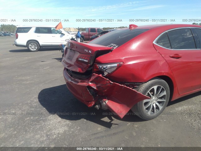 Photo 5 VIN: 19UUB1F30HA005032 - ACURA TLX 