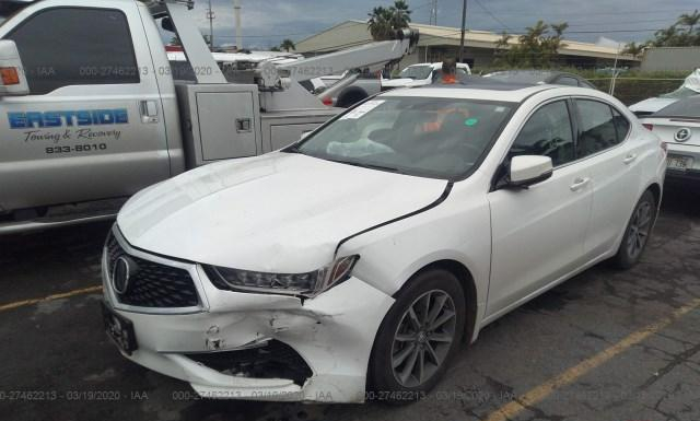 Photo 1 VIN: 19UUB1F30JA011399 - ACURA TLX 