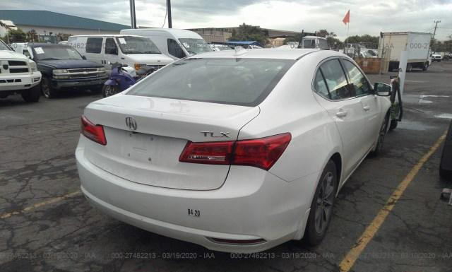 Photo 3 VIN: 19UUB1F30JA011399 - ACURA TLX 