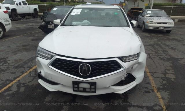 Photo 5 VIN: 19UUB1F30JA011399 - ACURA TLX 