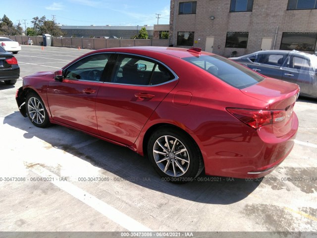 Photo 2 VIN: 19UUB1F30LA006996 - ACURA TLX 