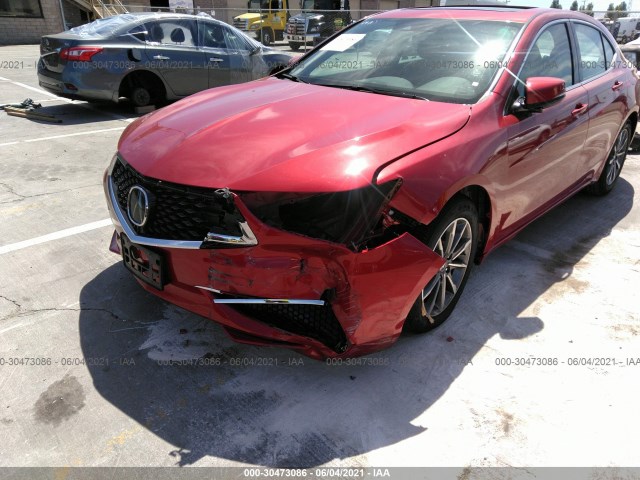 Photo 5 VIN: 19UUB1F30LA006996 - ACURA TLX 