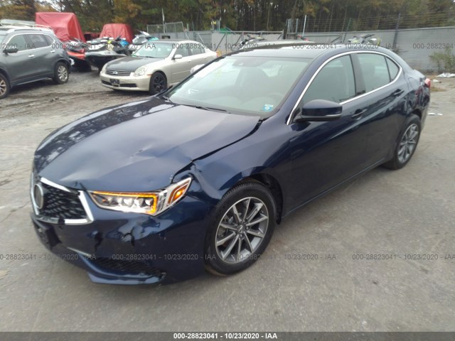 Photo 1 VIN: 19UUB1F30LA015424 - ACURA TLX 