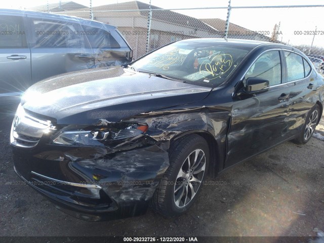 Photo 5 VIN: 19UUB1F31GA009217 - ACURA TLX 