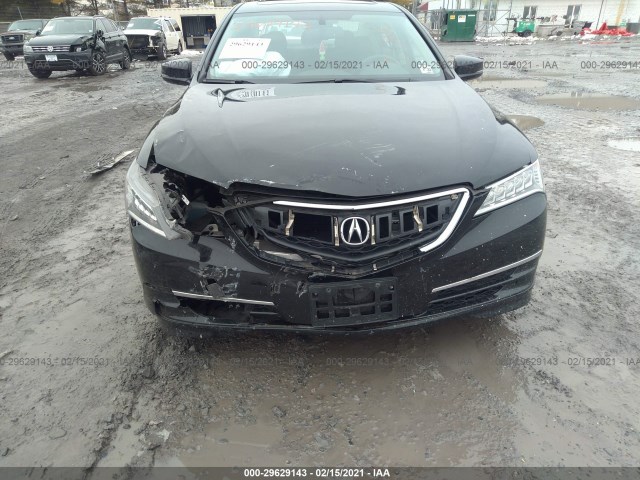 Photo 5 VIN: 19UUB1F31HA004469 - ACURA TLX 