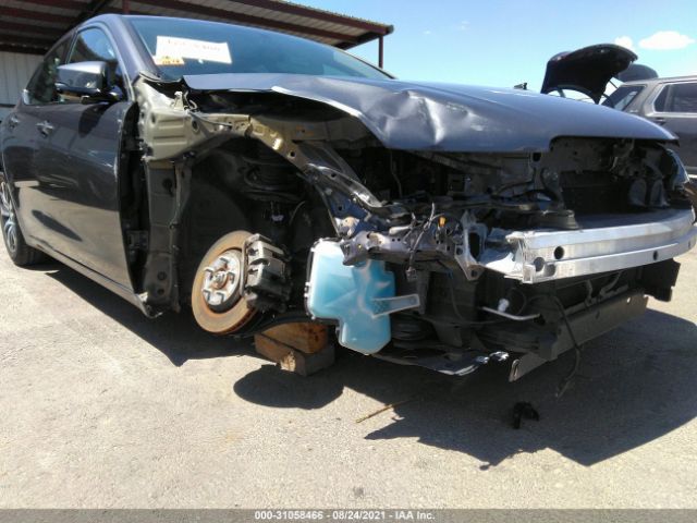 Photo 5 VIN: 19UUB1F31HA007808 - ACURA TLX 