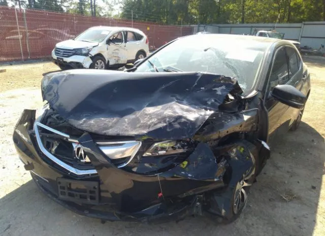 Photo 5 VIN: 19UUB1F32FA010892 - ACURA TLX 