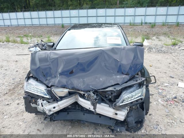 Photo 5 VIN: 19UUB1F32FA018104 - ACURA TLX 