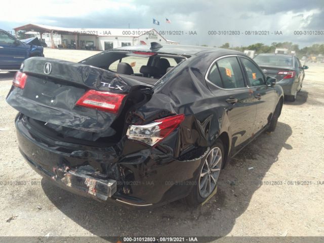 Photo 3 VIN: 19UUB1F32JA001506 - ACURA TLX 