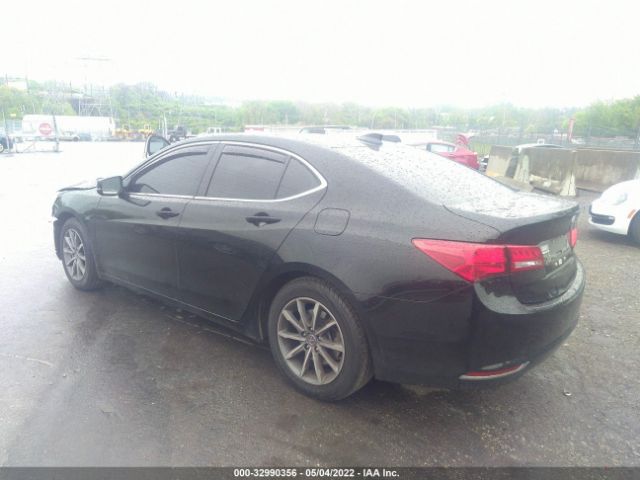 Photo 2 VIN: 19UUB1F32JA005071 - ACURA TLX 