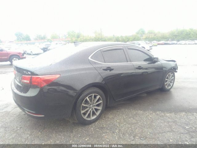 Photo 3 VIN: 19UUB1F32JA005071 - ACURA TLX 