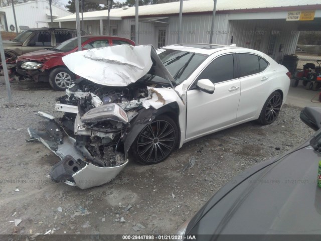 Photo 1 VIN: 19UUB1F33JA000445 - ACURA TLX 