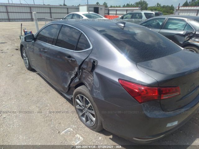 Photo 5 VIN: 19UUB1F33KA010703 - ACURA TLX 