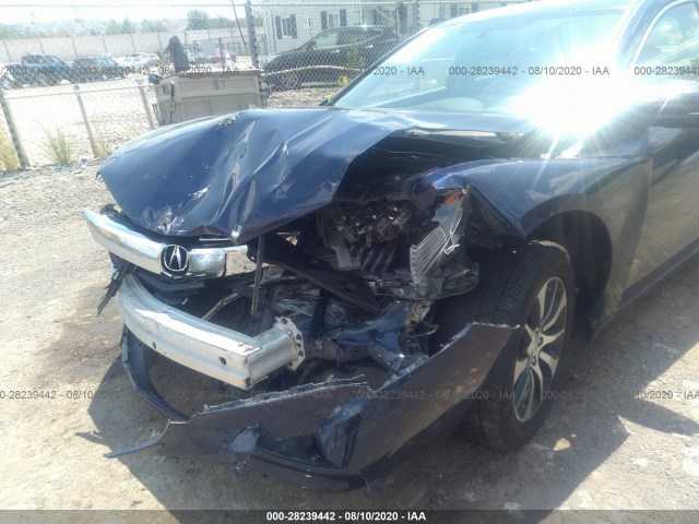 Photo 5 VIN: 19UUB1F34FA026883 - ACURA TLX 