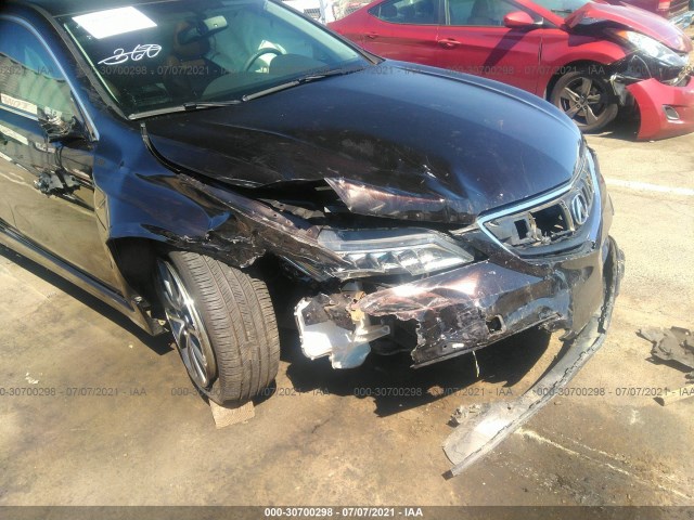 Photo 5 VIN: 19UUB1F34FA029251 - ACURA TLX 