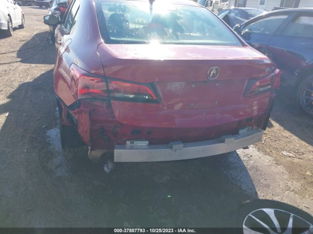 Photo 5 VIN: 19UUB1F34HA004742 - ACURA TLX 