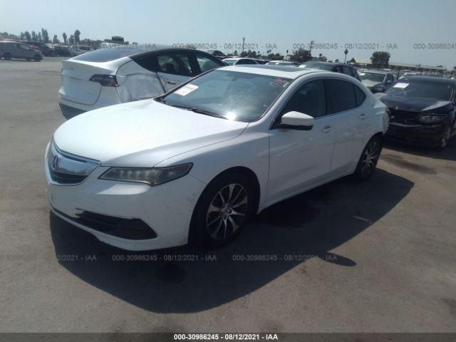 Photo 1 VIN: 19UUB1F35FA017948 - ACURA TLX 