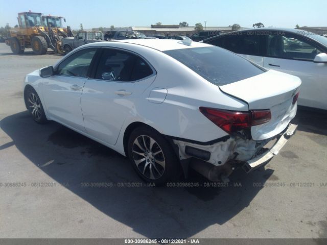 Photo 2 VIN: 19UUB1F35FA017948 - ACURA TLX 