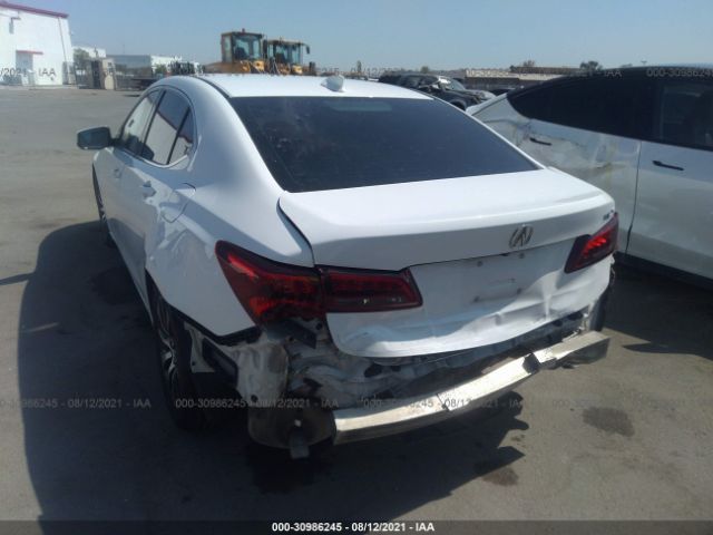 Photo 5 VIN: 19UUB1F35FA017948 - ACURA TLX 