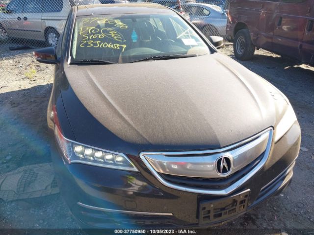 Photo 5 VIN: 19UUB1F35HA003972 - ACURA TLX 