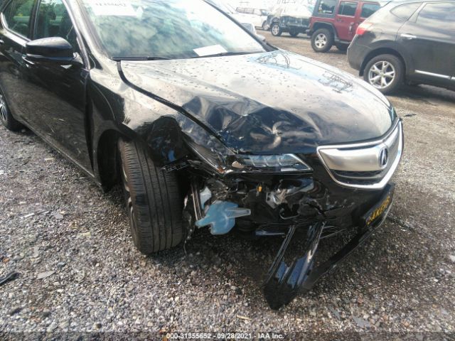 Photo 5 VIN: 19UUB1F35HA010422 - ACURA TLX 