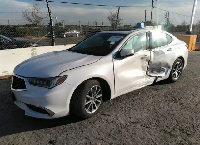 Photo 5 VIN: 19UUB1F35KA000917 - ACURA TLX 