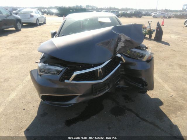 Photo 5 VIN: 19UUB1F35LA016682 - ACURA TLX 