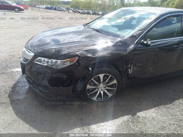 Photo 5 VIN: 19UUB1F36GA010072 - ACURA TLX 