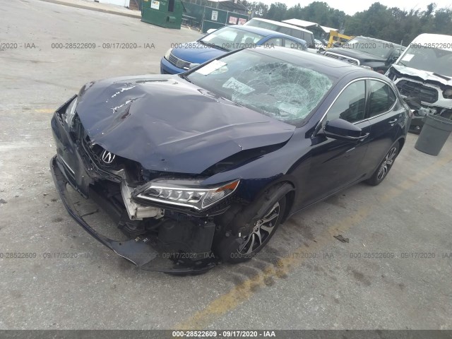 Photo 1 VIN: 19UUB1F36HA009456 - ACURA TLX 