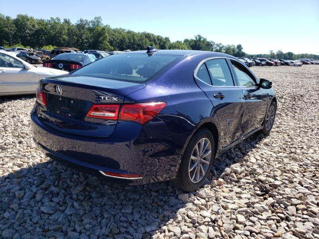 Photo 3 VIN: 19UUB1F36JA008040 - ACURA TLX 