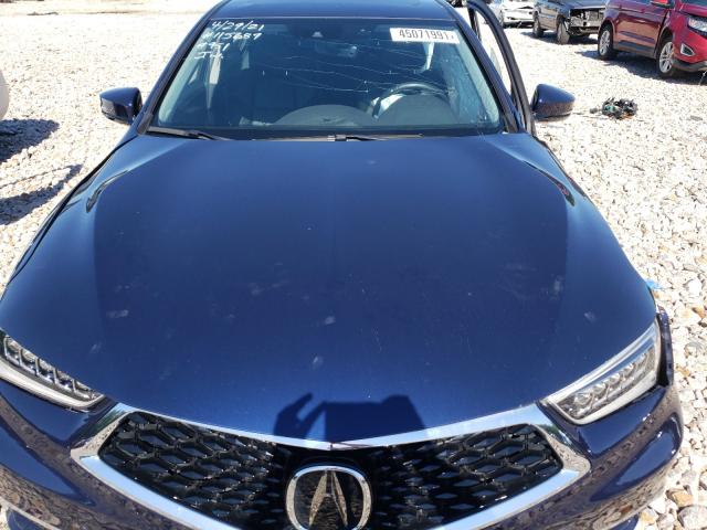 Photo 6 VIN: 19UUB1F36JA008040 - ACURA TLX 