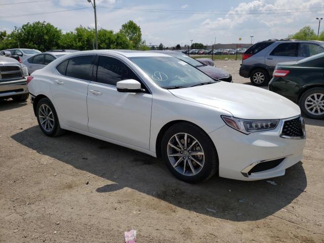 Photo 3 VIN: 19UUB1F36LA004170 - ACURA TLX 