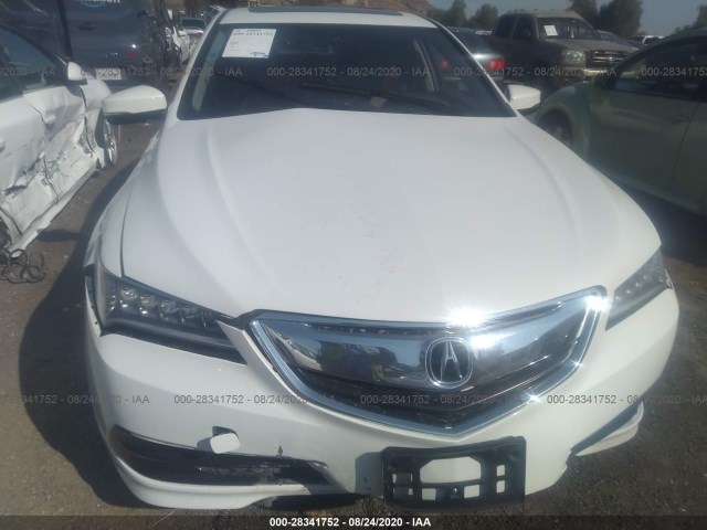 Photo 5 VIN: 19UUB1F37GA003583 - ACURA TLX 