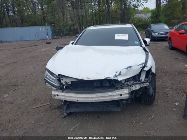 Photo 5 VIN: 19UUB1F37GA004622 - ACURA TLX 